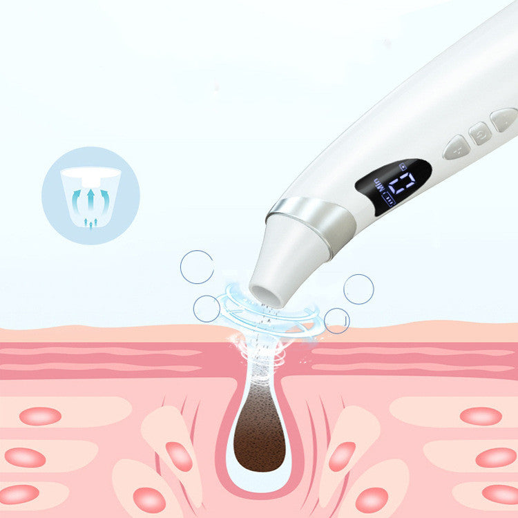 Electric Blackhead Remover – Visual Pore Vacuum & Skin Care Tool