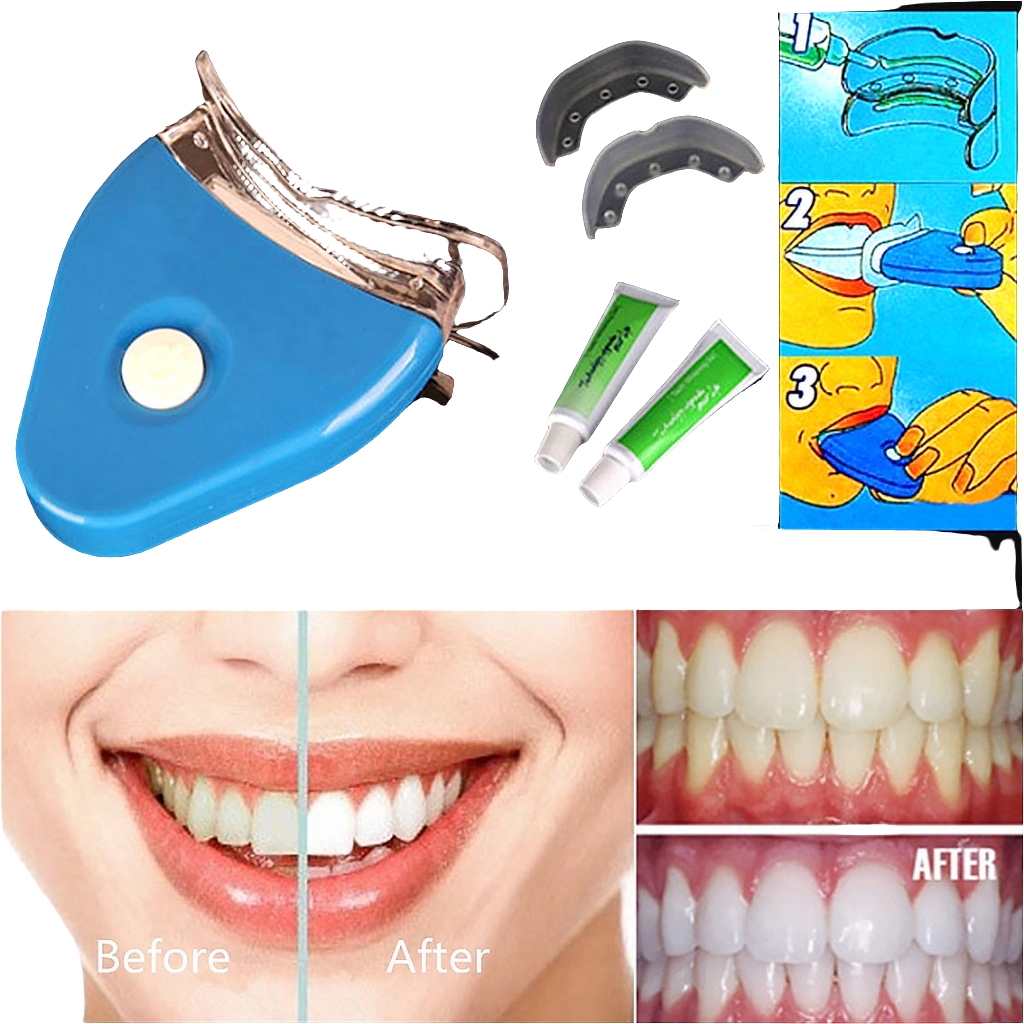 LED Teeth Whitening Kit – Professional Oral Gel & Dental Care System