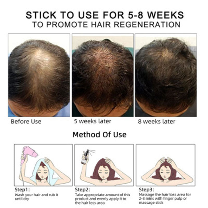 Hair Growth Oil – Natural Scalp Treatment for Thicker, Healthier Hair