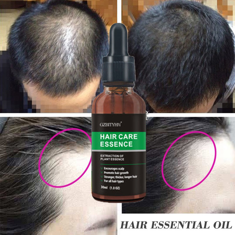 Hair Growth Oil – Natural Scalp Treatment for Thicker, Healthier Hair