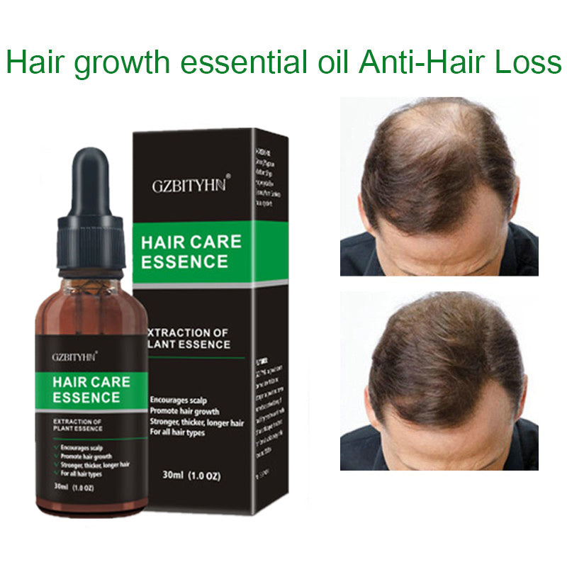 Hair Growth Oil – Natural Scalp Treatment for Thicker, Healthier Hair