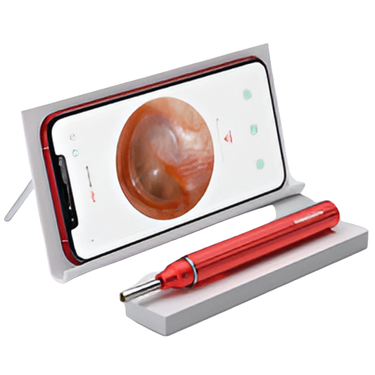 Wireless Ear Cleaning Camera - Smart Wax Remove with HD Visuals